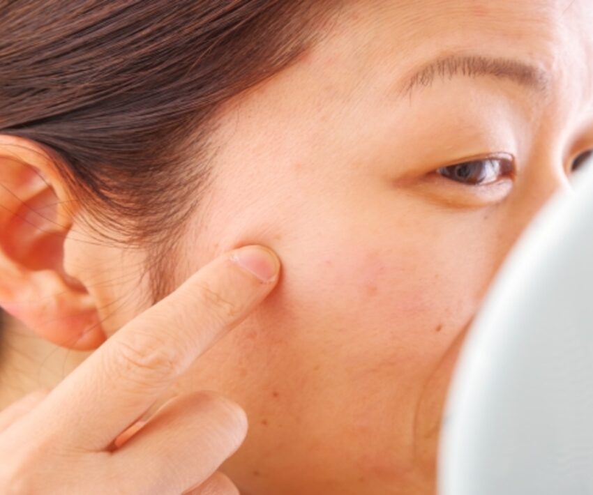 【医師が徹底解説】肌に色素沈着があると医療脱毛できない？