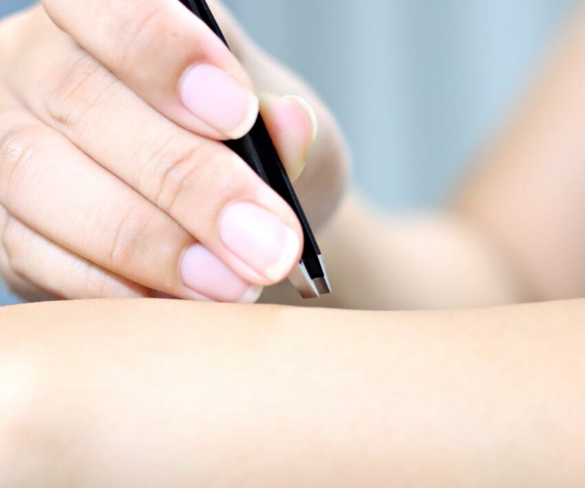 脱毛期間中に毛抜きがNGな3つの理由！脱毛と毛抜きの関係を解説