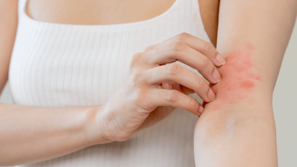 【医師監修】脱毛後に赤み・かゆみが出る原因!対処法や予防法もご紹介