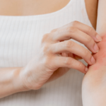 【医師監修】脱毛後に赤み・かゆみが出る原因!対処法や予防法もご紹介