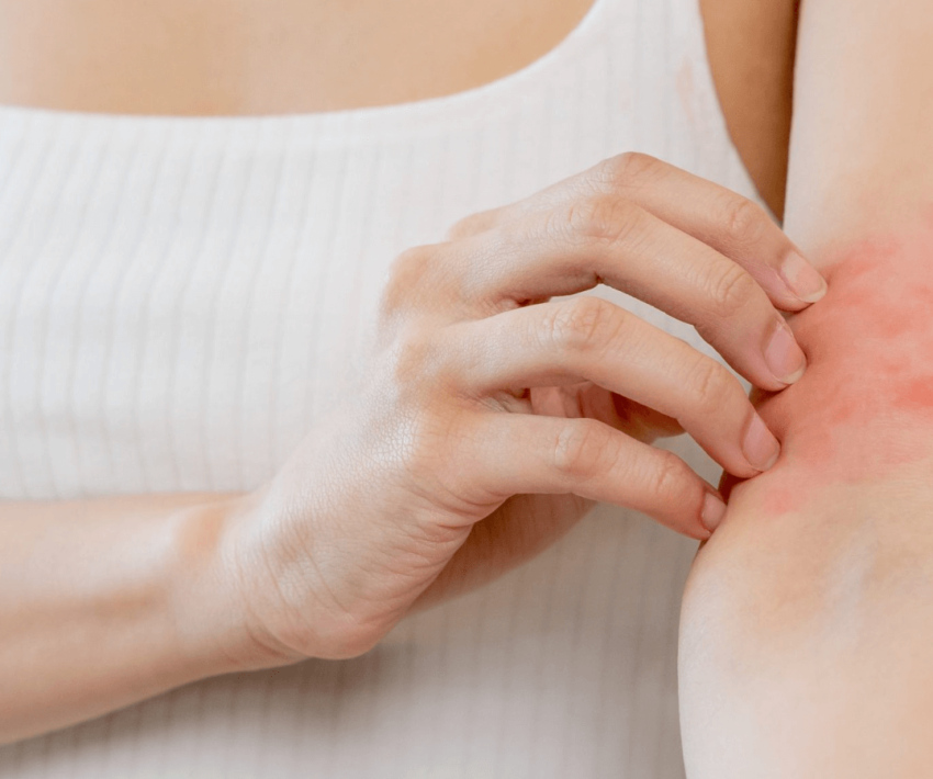 【医師監修】脱毛後に赤み・かゆみが出る原因！対処法や予防法もご紹介